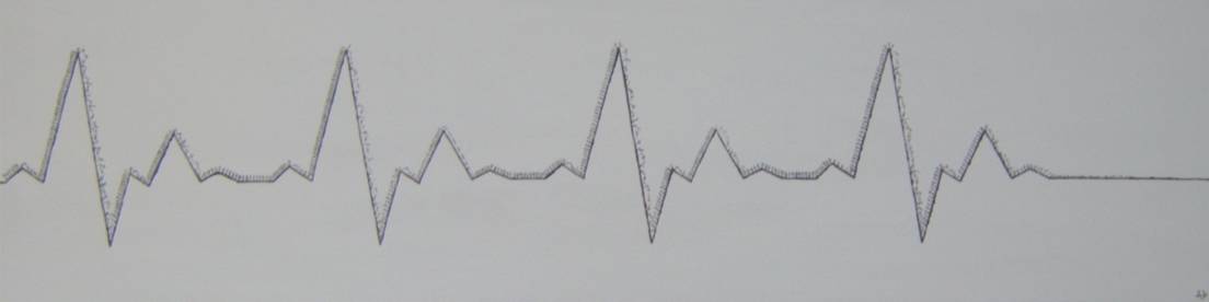 berg auf berg ab.jpg